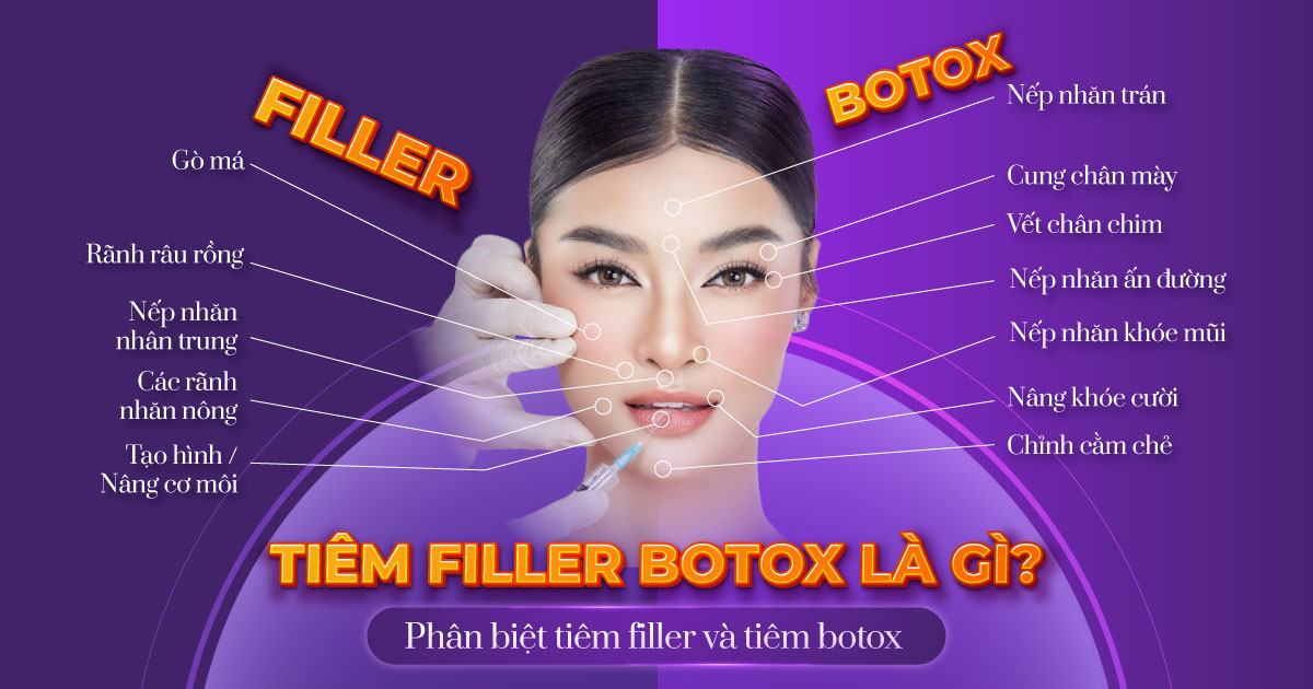 tiêm filler botox là gì