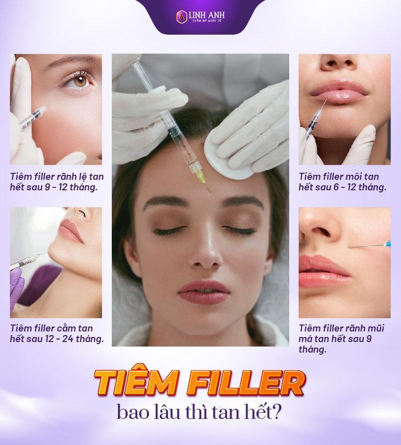 tiêm filler bao lâu thì tan - Thẩm mỹ Quốc tế Linh Anh tiêm filler cằm bao lâu thì tan