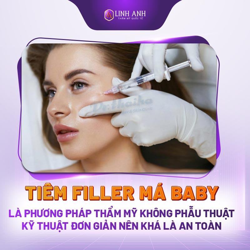 tiêm filler má - Thẩm mỹ Quốc tế Linh Anh tiêm filler má baby có hại không