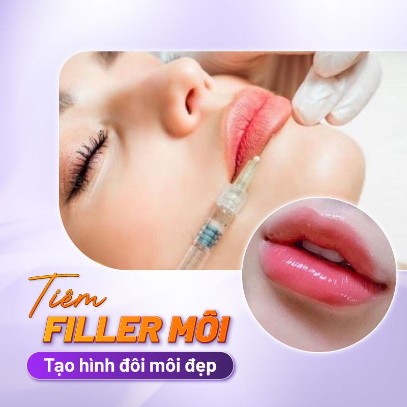 Tiêm Filler môi là gì