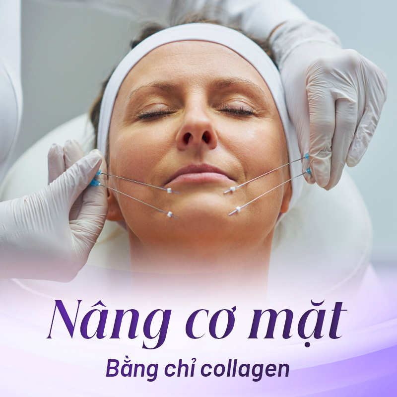 dịch vụ nâng cơ mặt