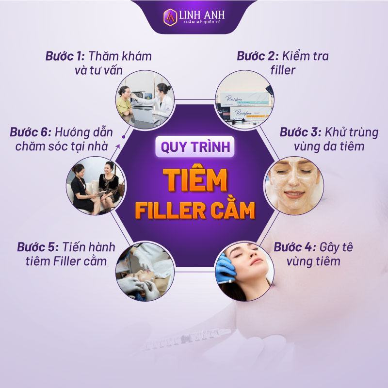 tiêm filler cằm bao lâu thì ổn định filler tiêm cằm