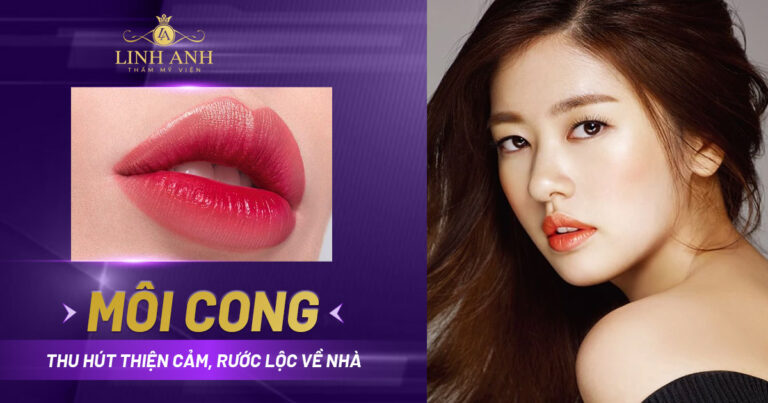 Môi cong là đẹp hay xấu? Tính cách, vận mệnh và cách sở hữu môi cong