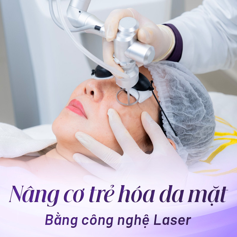 nâng cơ mặt uy tín