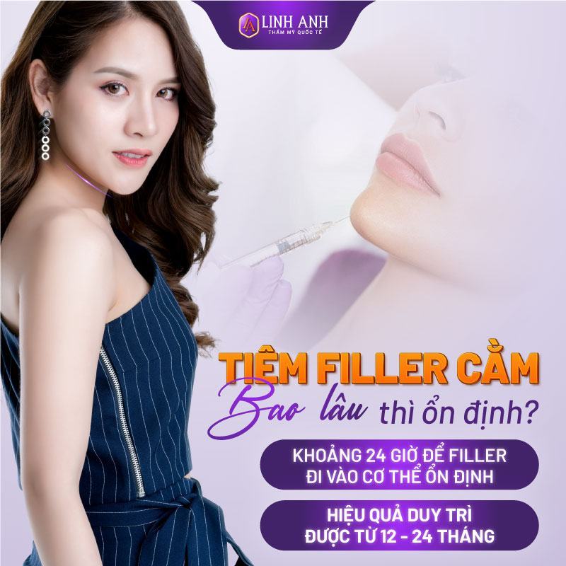 filler tiêm cằm tiêm filler cằm bao lâu thì ổn định