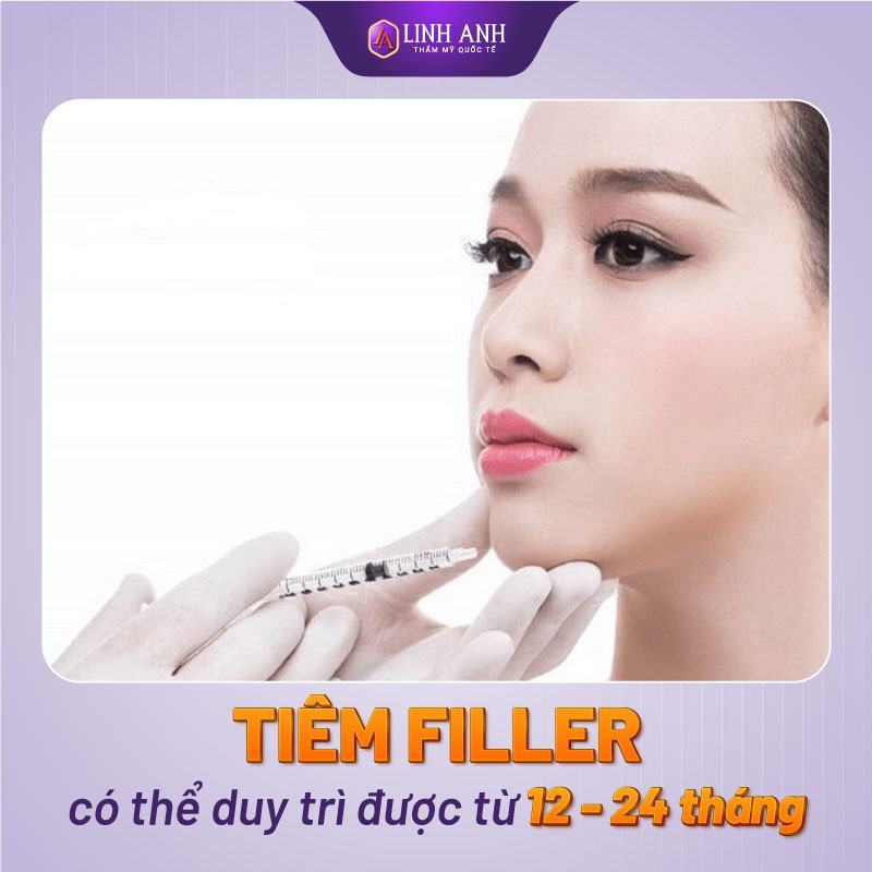 tiêm filler giữ được bao lâu