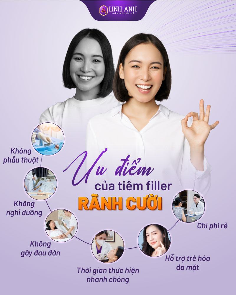 tiêm filler rãnh cười bao lâu thì mềm tiêm filler rãnh cười có nguy hiểm không
