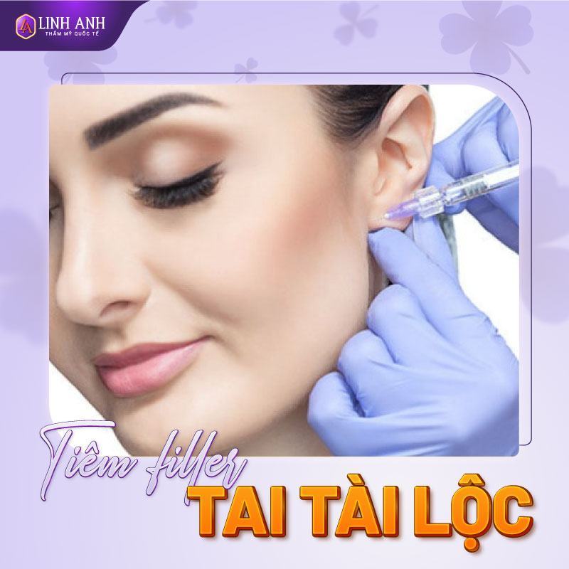 tiêm filler tai tài lộc giá bao nhiêu - Thẩm mỹ Quốc tế Linh Anh tiêm filler tai
