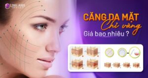 căng da mặt chỉ vàng giá bao nhiêu