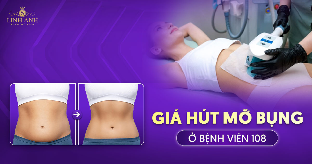 giá hút mỡ bụng ở bệnh viện 108