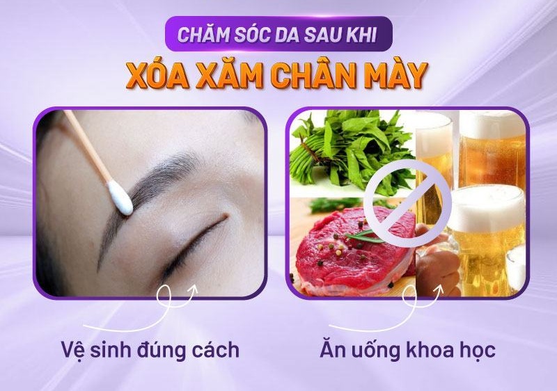 hình ảnh khi xóa xăm lông mày hình ảnh khi xóa xăm lông mày