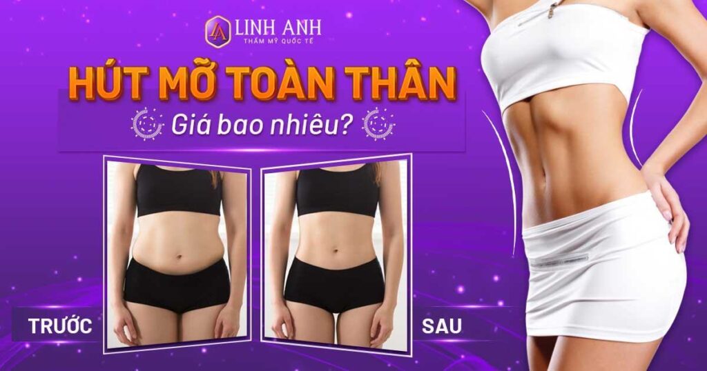 hút mỡ toàn thân bao nhiêu tiền