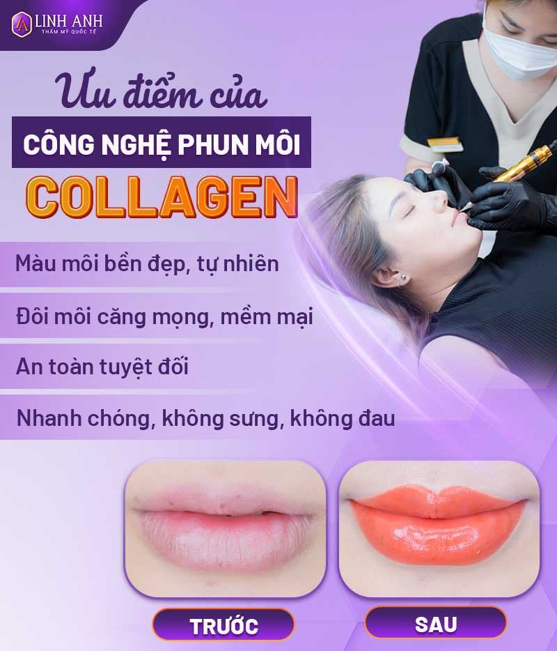 kỹ thuật phun môi mới nhất