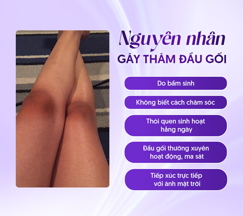 laser trị thâm đầu gối giá bao nhiêu laser trị thâm đầu gối giá bao nhiêu