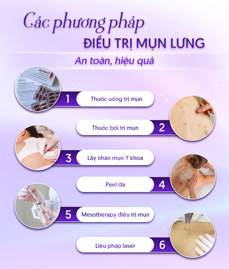 liệu trình trị mụn lưng bao nhiêu tiền liệu trình trị mụn lưng bao nhiêu tiền