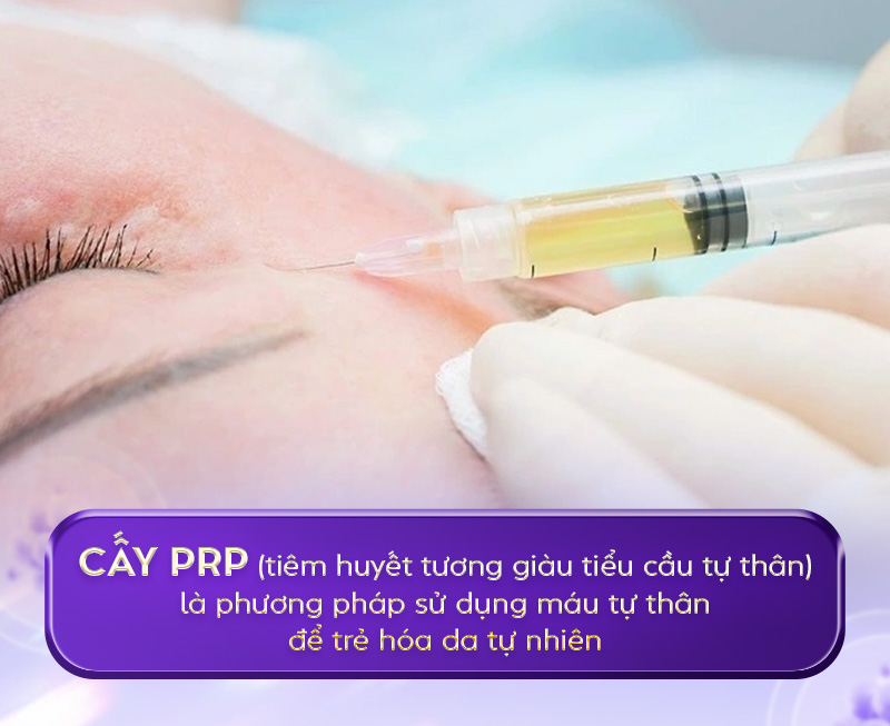 tiêm prp giá bao nhiêu tiêm prp giá bao nhiêu