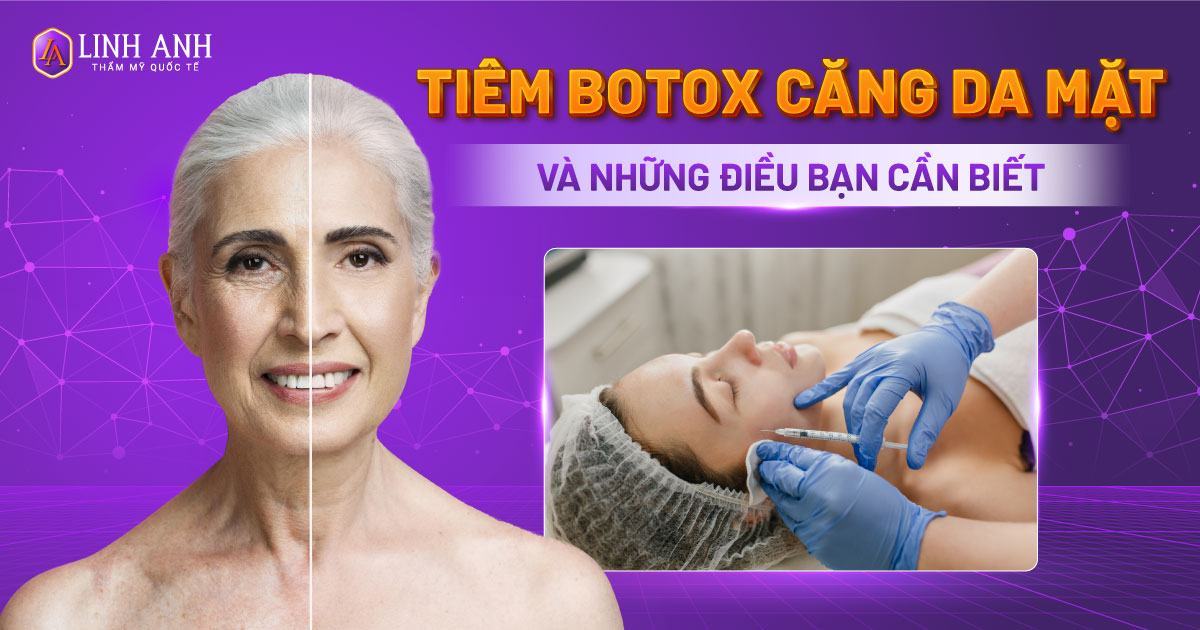 Tiêm botox căng da mặt: Những điều bạn cần biết