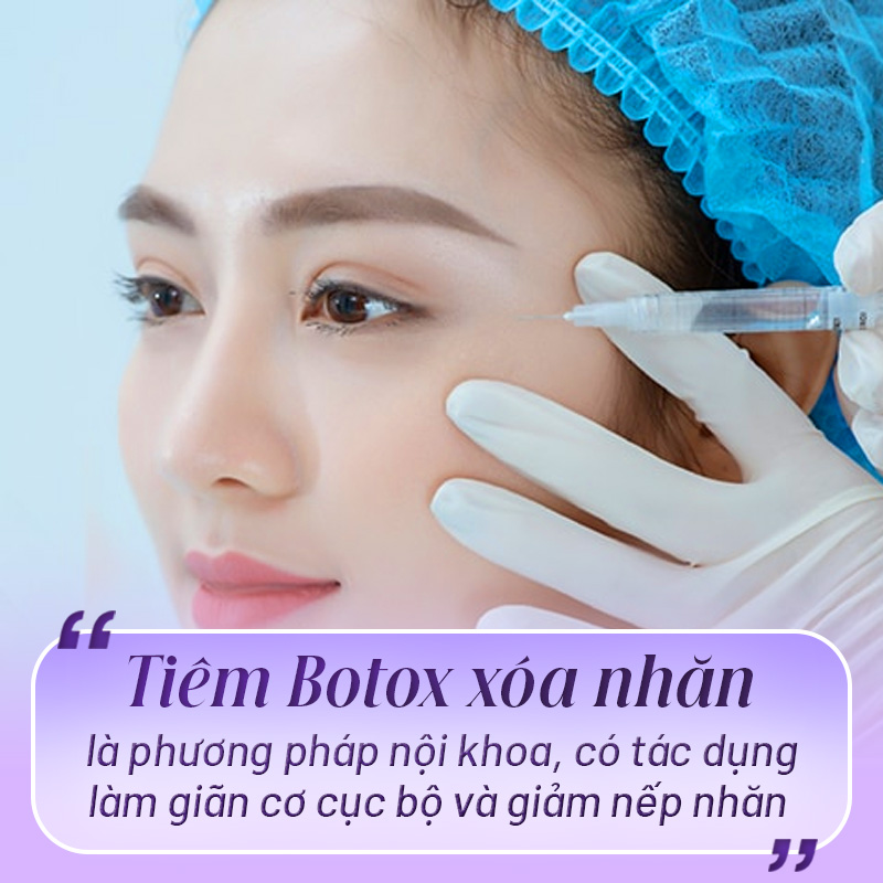 tiêm botox xóa nhăn đuôi mắt giá bao nhiêu