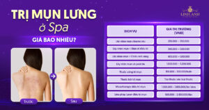 trị mụn lưng ở spa giá bao nhiêu