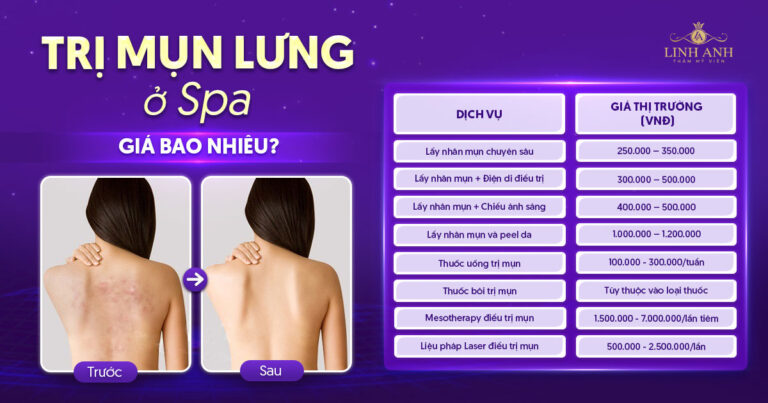 Trị mụn lưng ở spa giá bao nhiêu? Bảng giá mới nhất