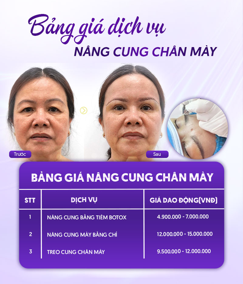CHI PHÍ nâng cung chân mày CHI PHÍ nâng cung chân mày