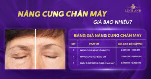 Nâng cung chân mày giá bao nhiêu