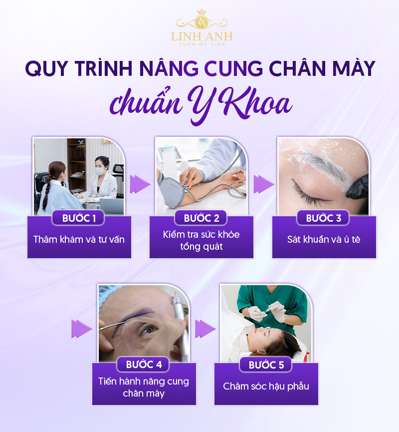 bảng giá nâng cung mày bảng giá nâng cung mày