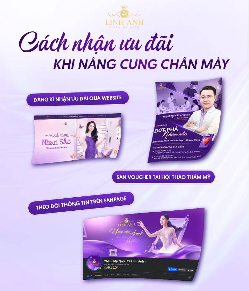 chi phí nâng cung mày chi phí nâng cung mày
