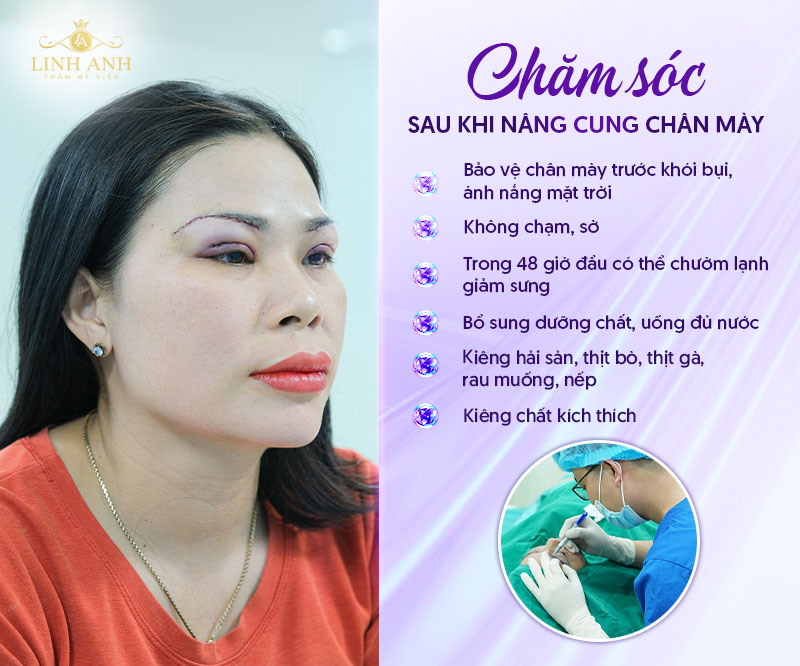 giá nâng cung chân mày mới nhất giá nâng cung chân mày mới nhất