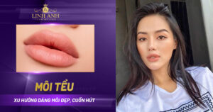 môi tều