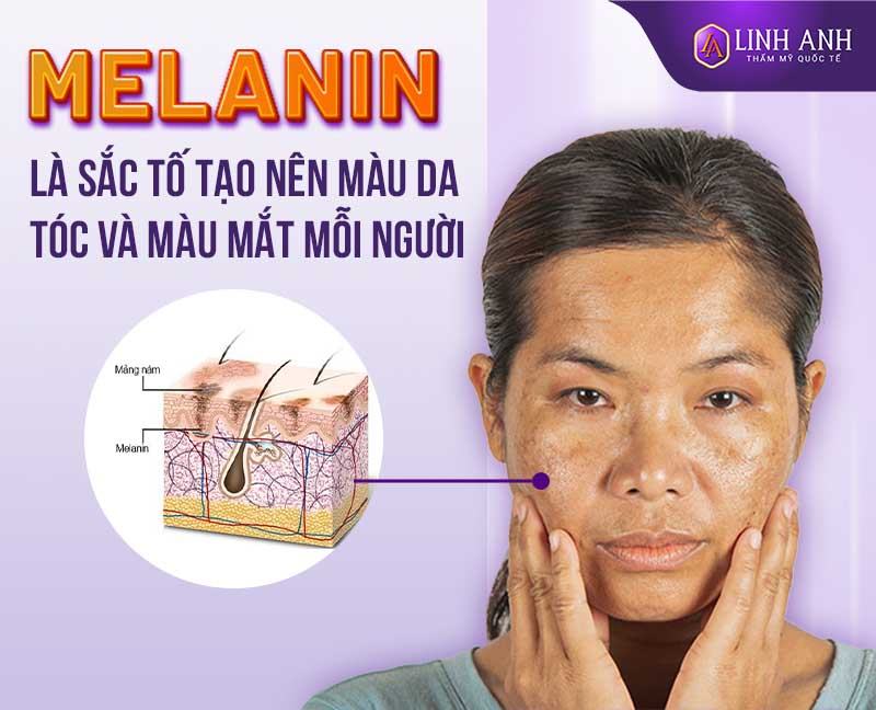 cách làm giảm sắc tố melanin trong da