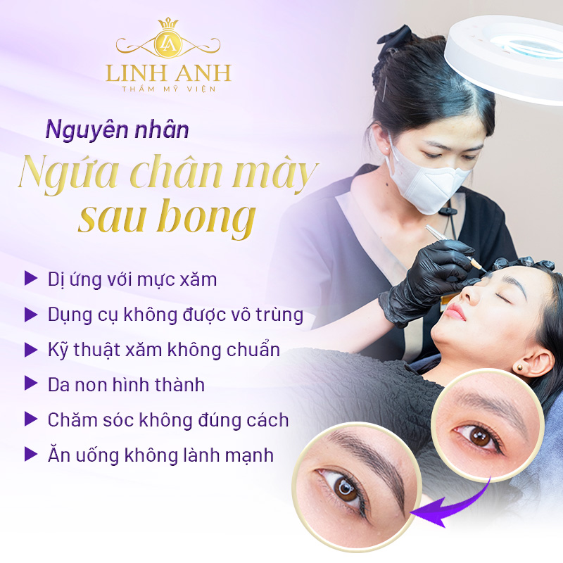 điêu khắc chân mày bị ngứa