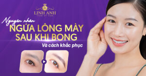 ngứa lông mày sau khi bong