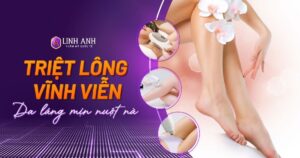 triệt lông vĩnh viễn