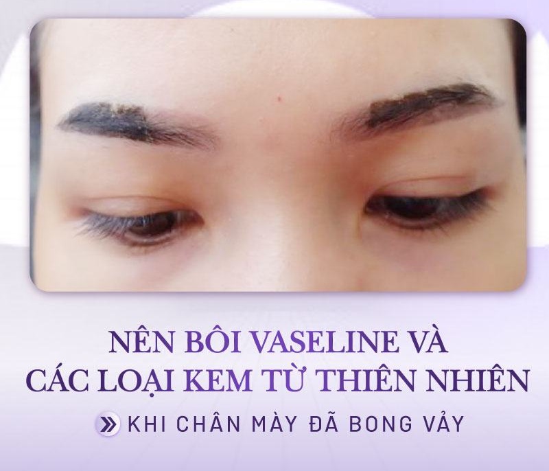 cach cham soc sau Dieu khac long may