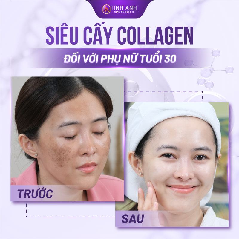 collagen nào tốt cho phụ nữ 30 tuổi