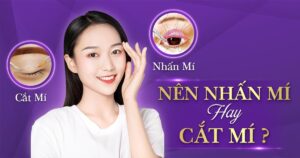 nên nhấn mí hay cắt mí