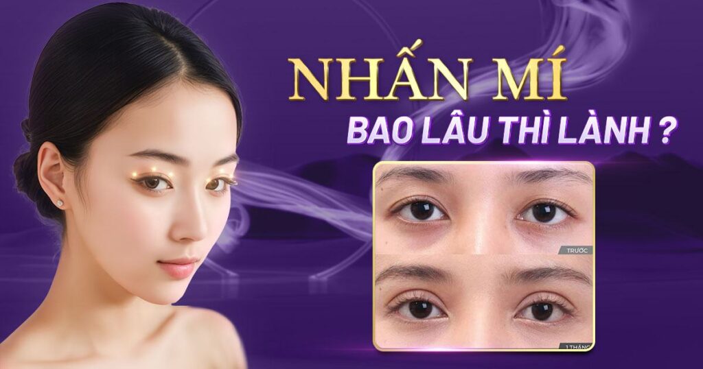 nhấn mí bao lâu thì lành