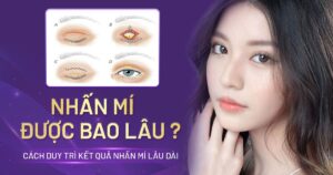 nhấn mí được bao lâu