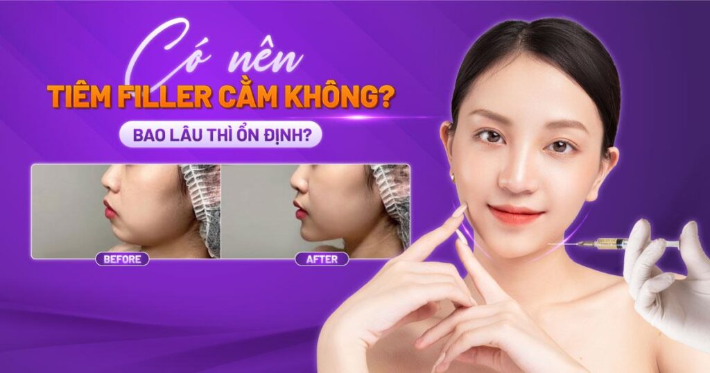 tiêm filler cằm