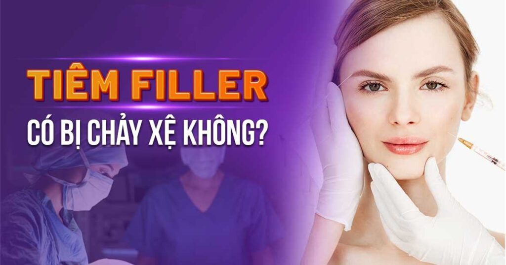 tiêm filler có bị chảy xệ không