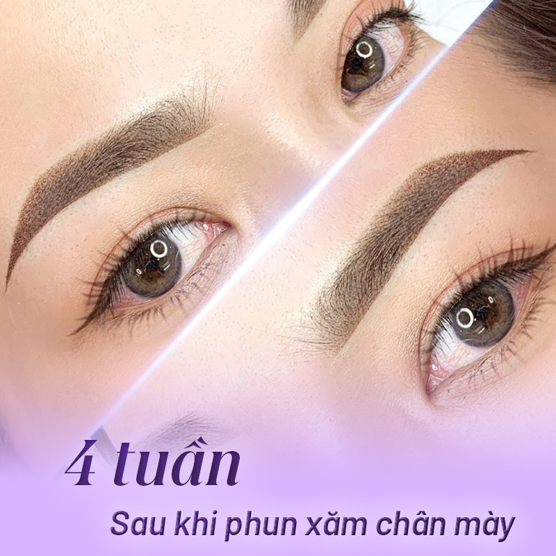 phục hồi mày