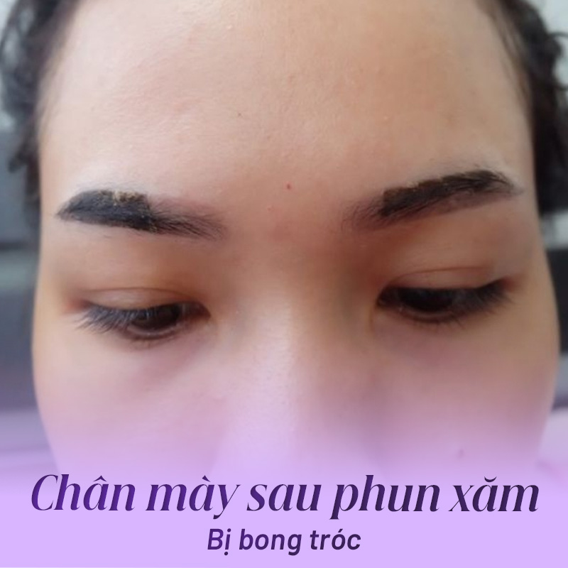 Xăm chân mày bị lỗi