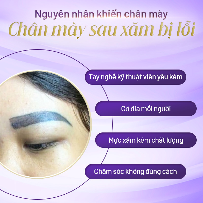 Xăm lông mày bị hỏng