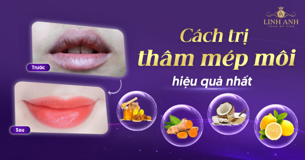 cách trị thâm mép môi