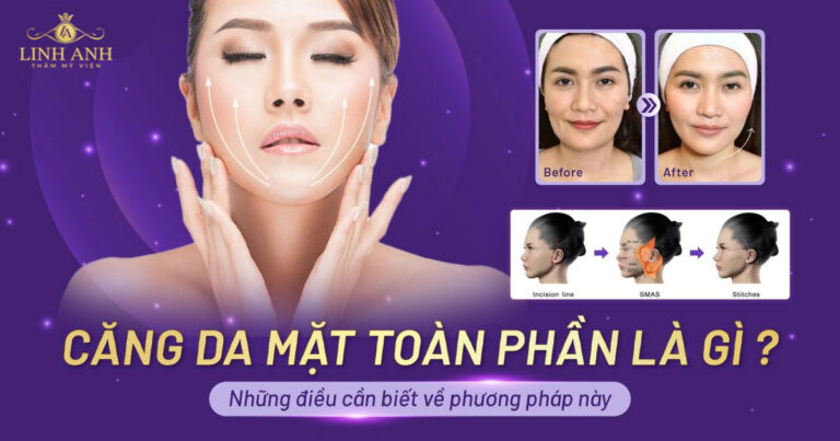 Căng da mặt toàn phần – Bí quyết trẻ hóa diện mạo lấy lại thanh xuân
