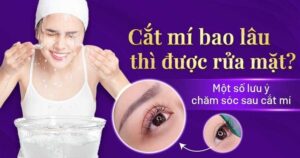 cắt mí bao lâu thì được rửa mặt