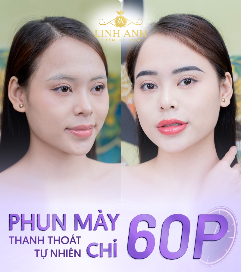 có nên phun chân mày không