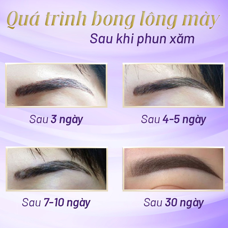 hình ảnh lông mày đang bong