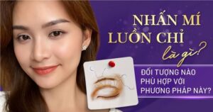 nhấn mí luồn chỉ